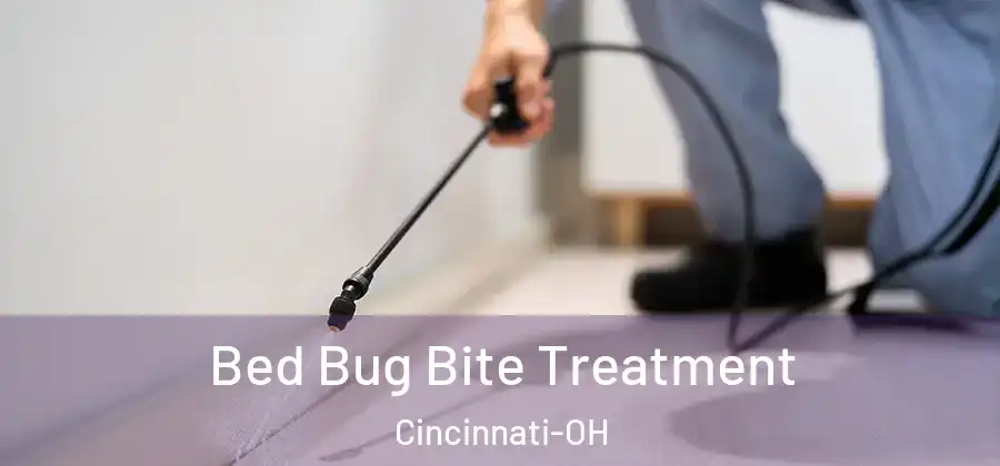  Bed Bug Bite Treatment Cincinnati-OH